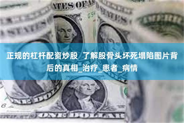 正规的杠杆配资炒股  了解股骨头坏死塌陷图片背后的真相_治疗_患者_病情